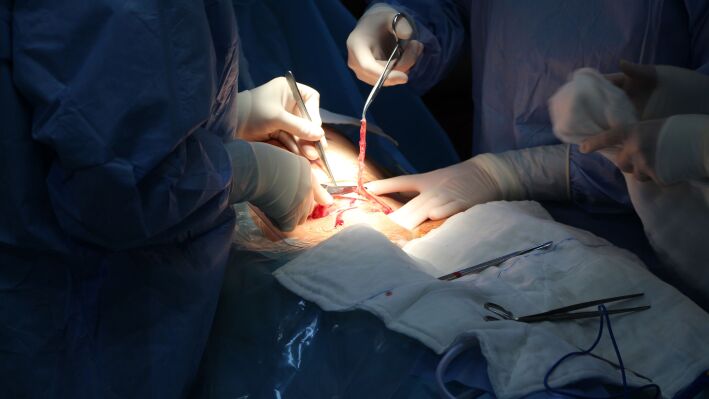جراحی های دستگاه گوارش